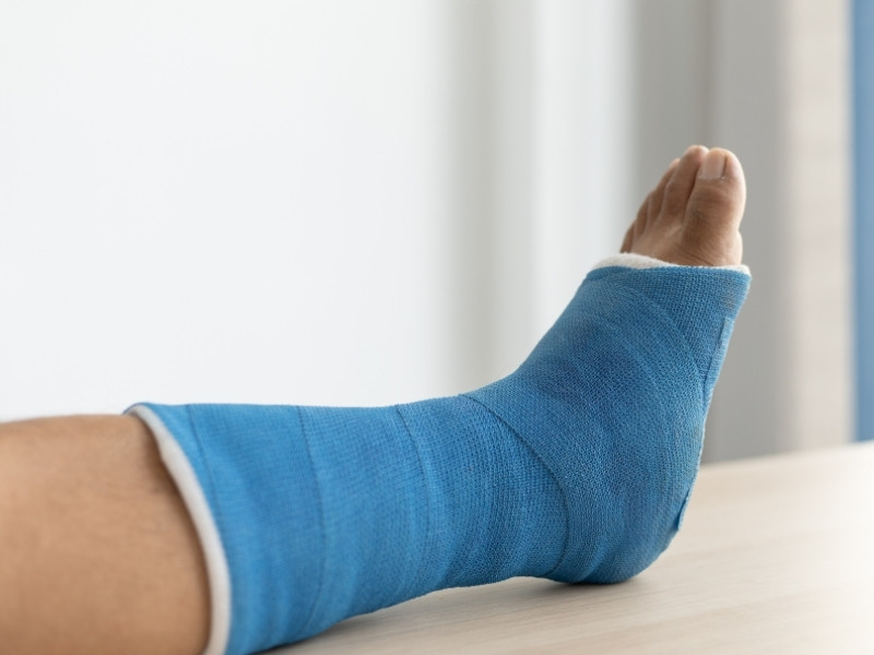 ayak kırığı tedavisi