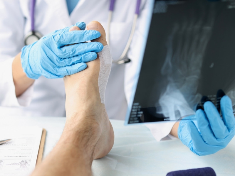 ayak problemleri tedavileri