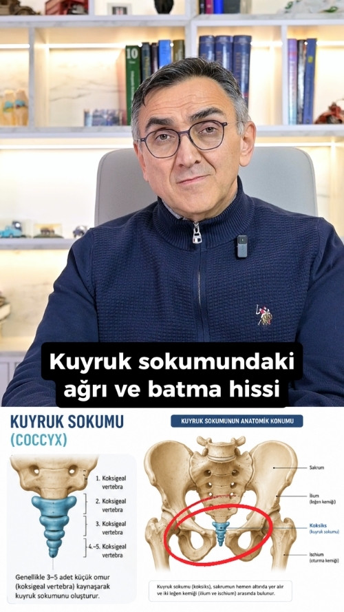 Kuyruk sokumunda yıllar sonra gelen ağrı
